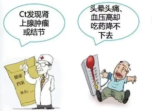 優(yōu)勢(shì)學(xué)科 | 泌尿外科 “后腹腔鏡下右腎上腺腫瘤切除術(shù)”為患者精準(zhǔn)“拆彈”