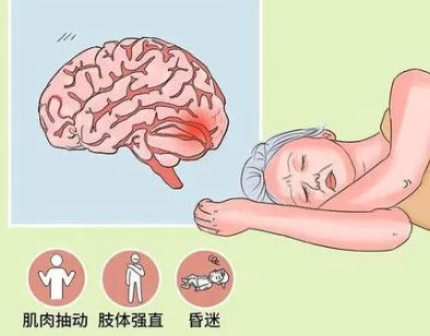優(yōu)勢(shì)學(xué)科|17 年癲癇折磨終解脫！錦州市中心醫(yī)院癲癇門(mén)診規(guī)范治療為患者點(diǎn)亮希望之光